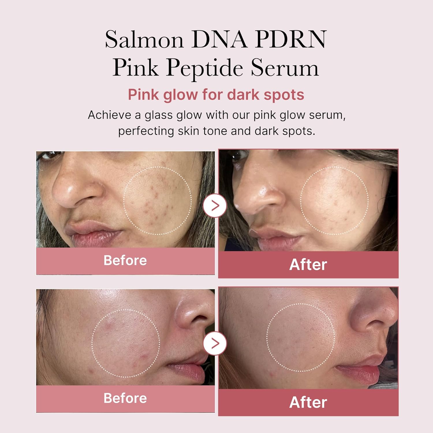 MEDICUBE Salmon DNA PDRN Pink Peptide Serum - 30 ml