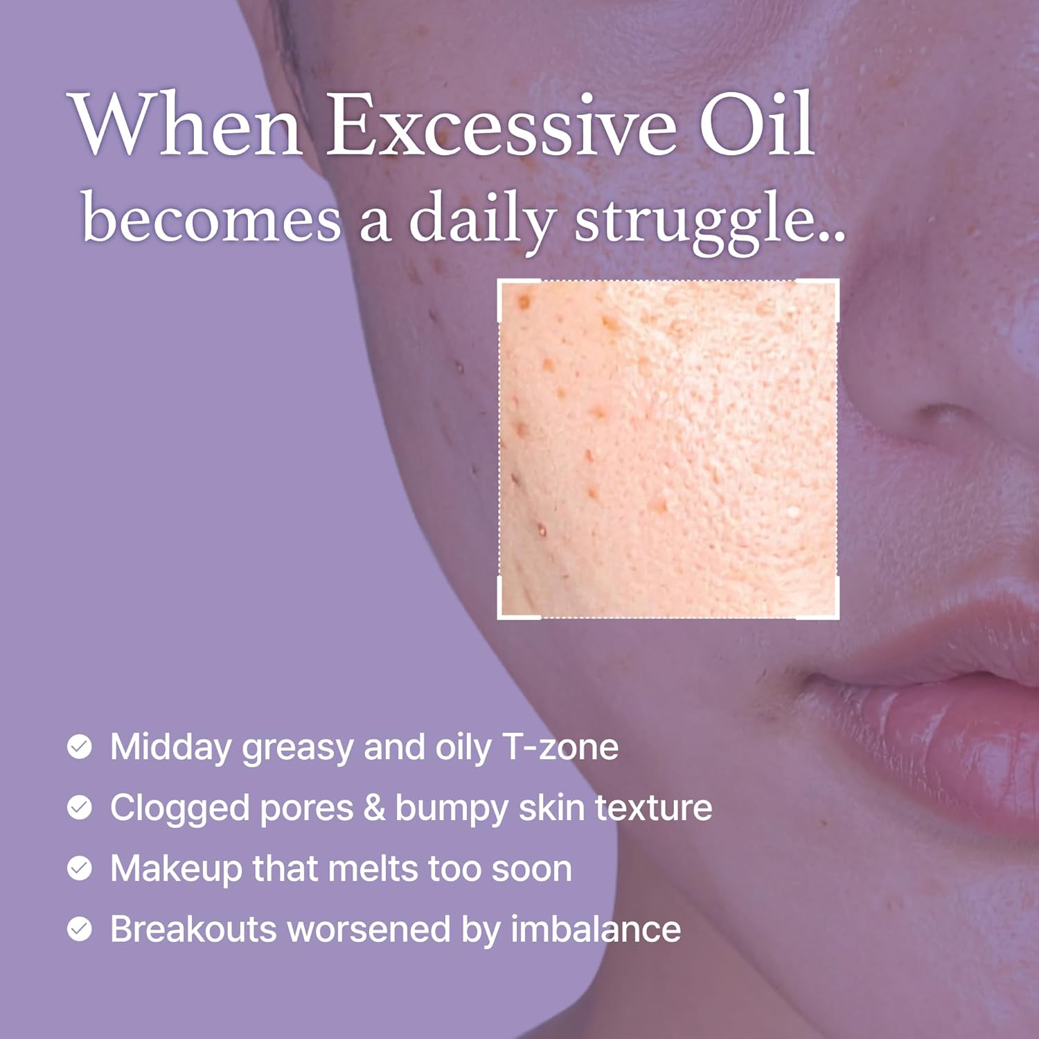 I'm from Black Rice Toner for Oily Skin - 150ml