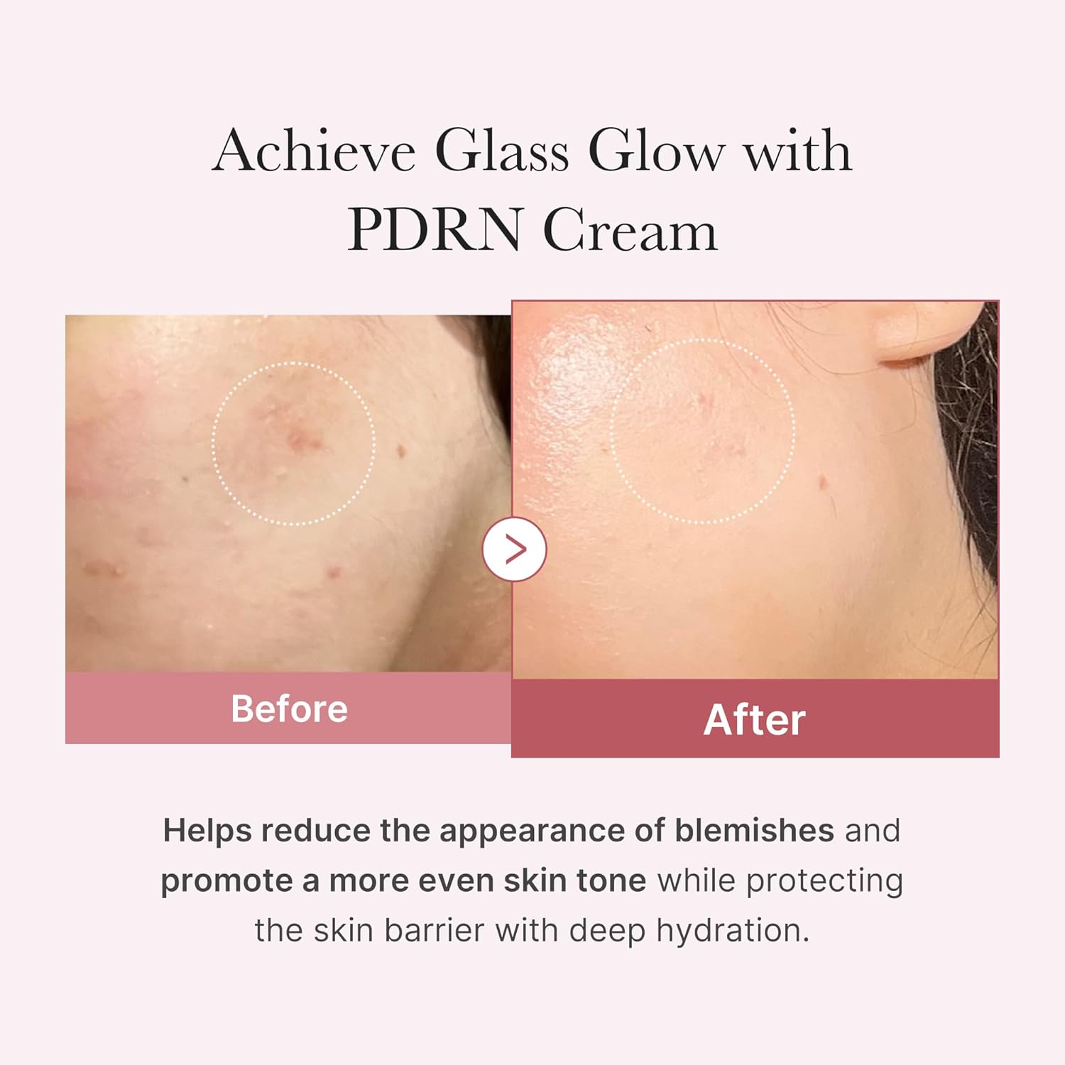 MEDICUBE Salmon DNA PDRN Pink Hyaluronic Moisturizing Cream
