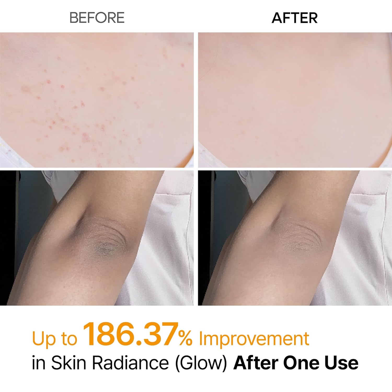 Dr. Melaxin Body Peel Shot Spray Face Peeling Kojic Acid Turmeric Spray - 200ml