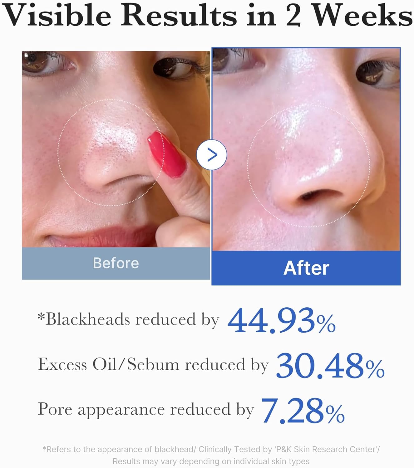 MEDICUBE Zero Pore Pads - 155 g
