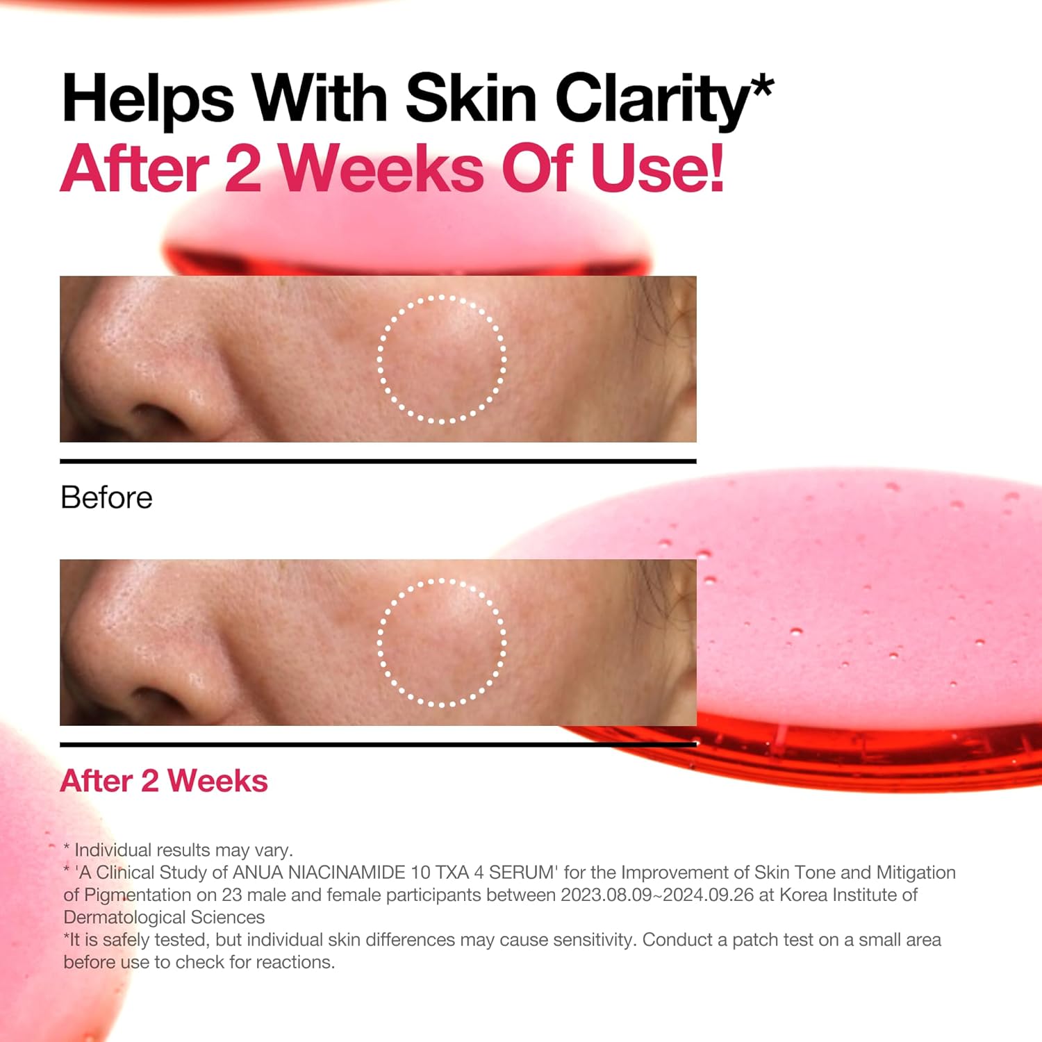 ANUA Niacinamide Dark Spot Prep & Boost Duo