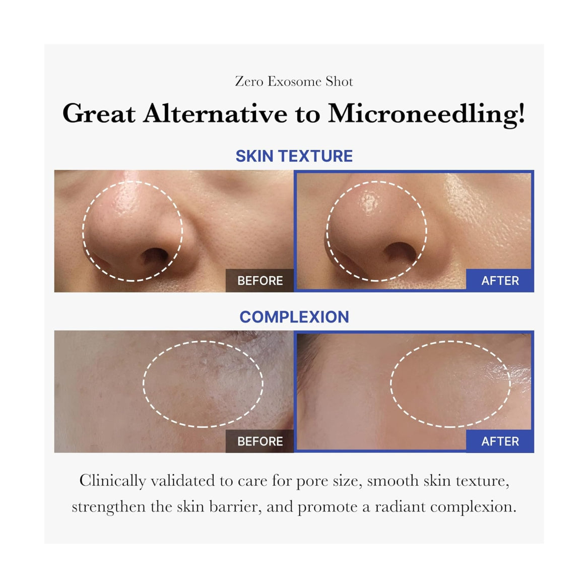 MEDICUBE Zero Exosome Shot 2,000 PPM Spicule Facial Serum