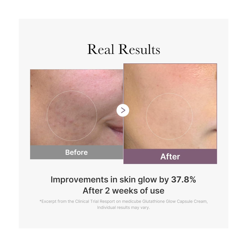 MEDICUBE AGE-R Glutathione Glow Capsule Facial Cream