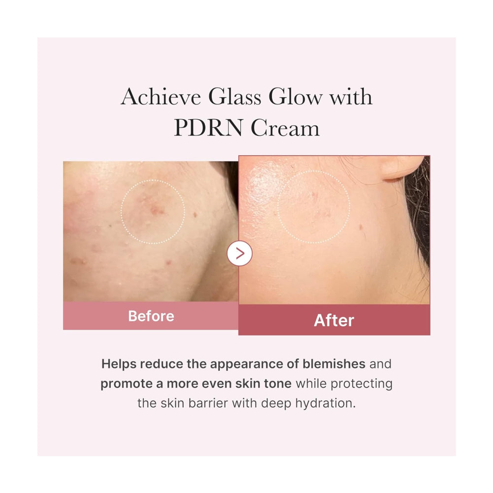 MEDICUBE Salmon DNA PDRN Pink Hyaluronic Moisturizing Cream