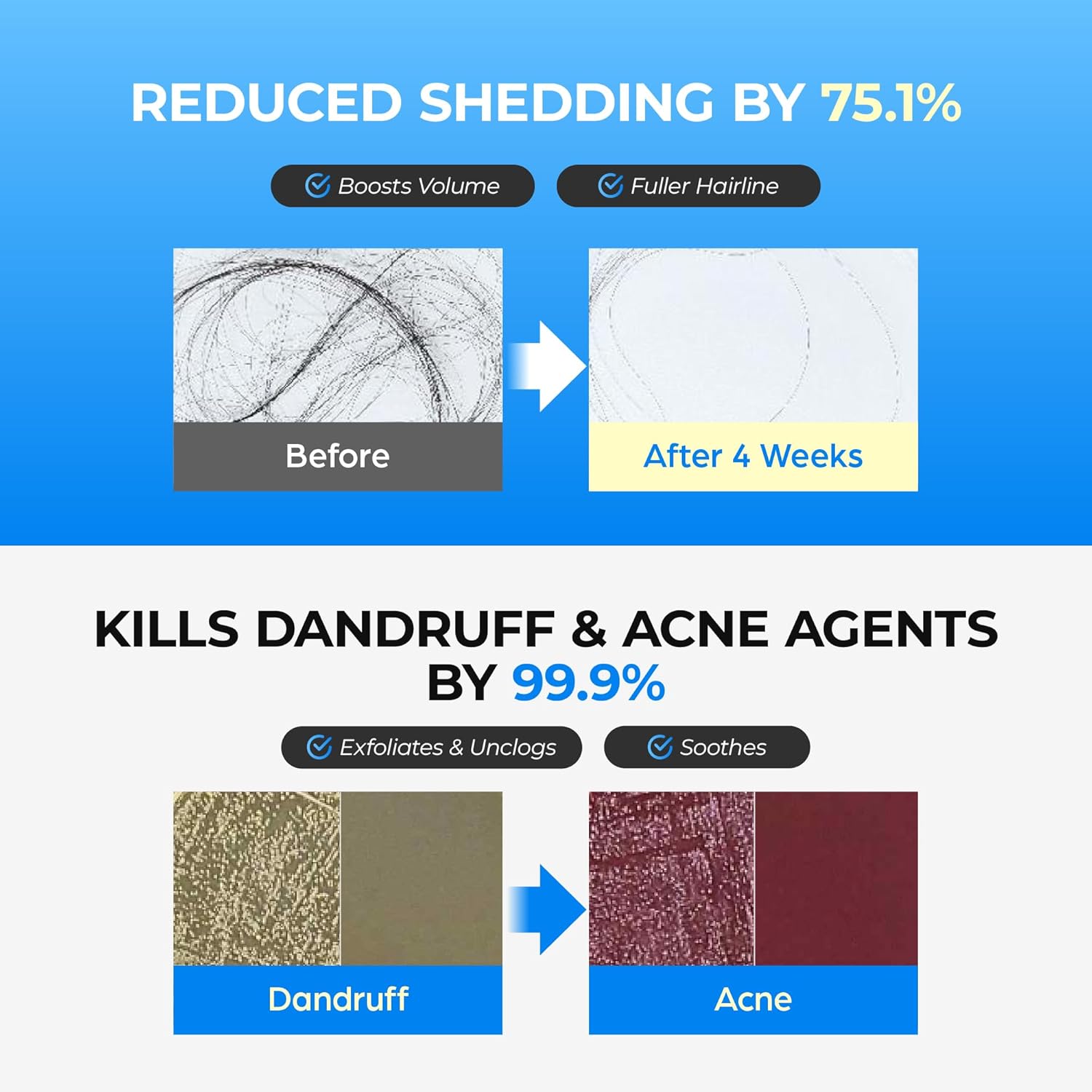 Seapuri Scalpy Bubble Tonic for Dry & Itchy Scalp Treatment - 100ml