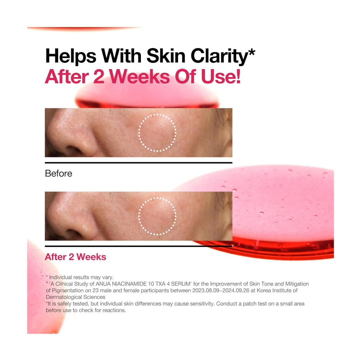 ANUA Niacinamide 10 + TXA 4 Serum