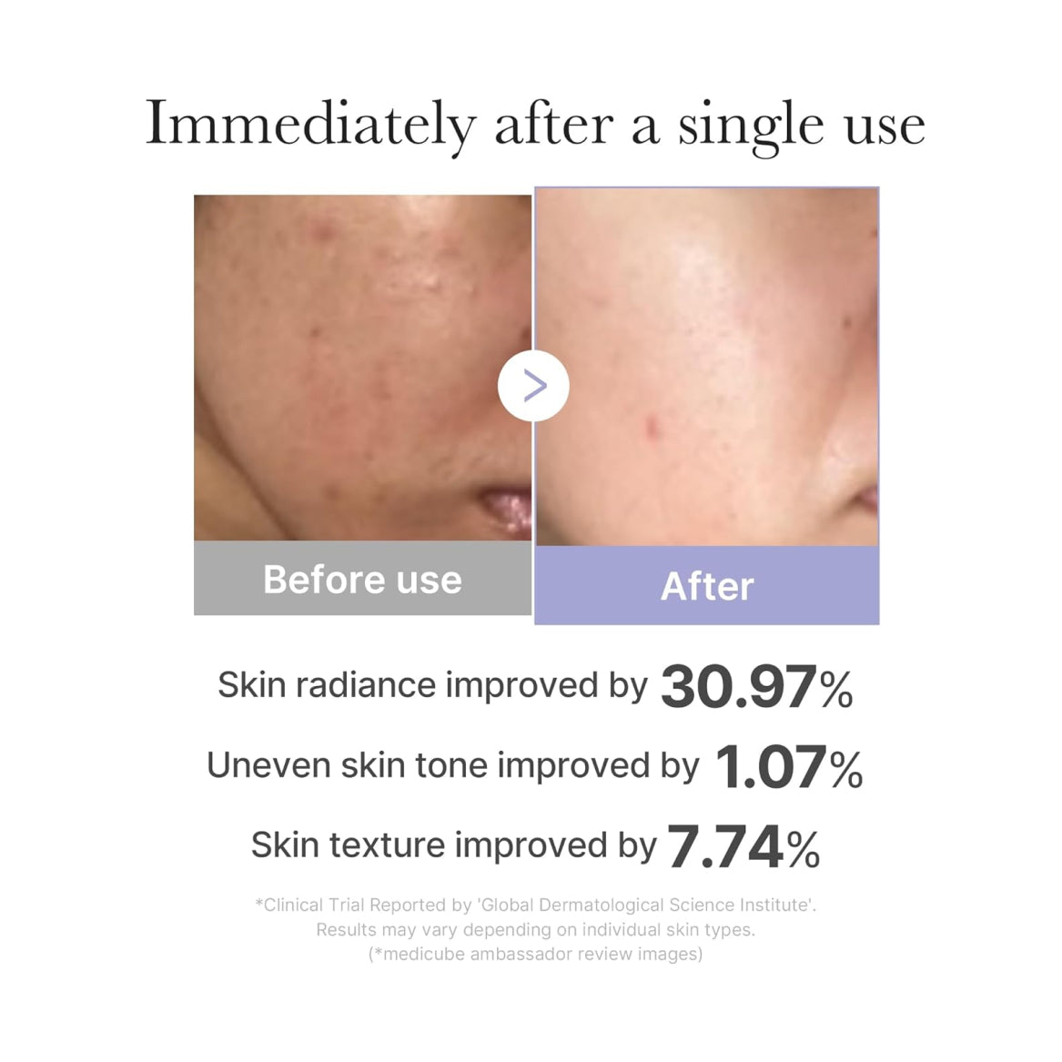 MEDICUBE Mini Booster Pro Pink