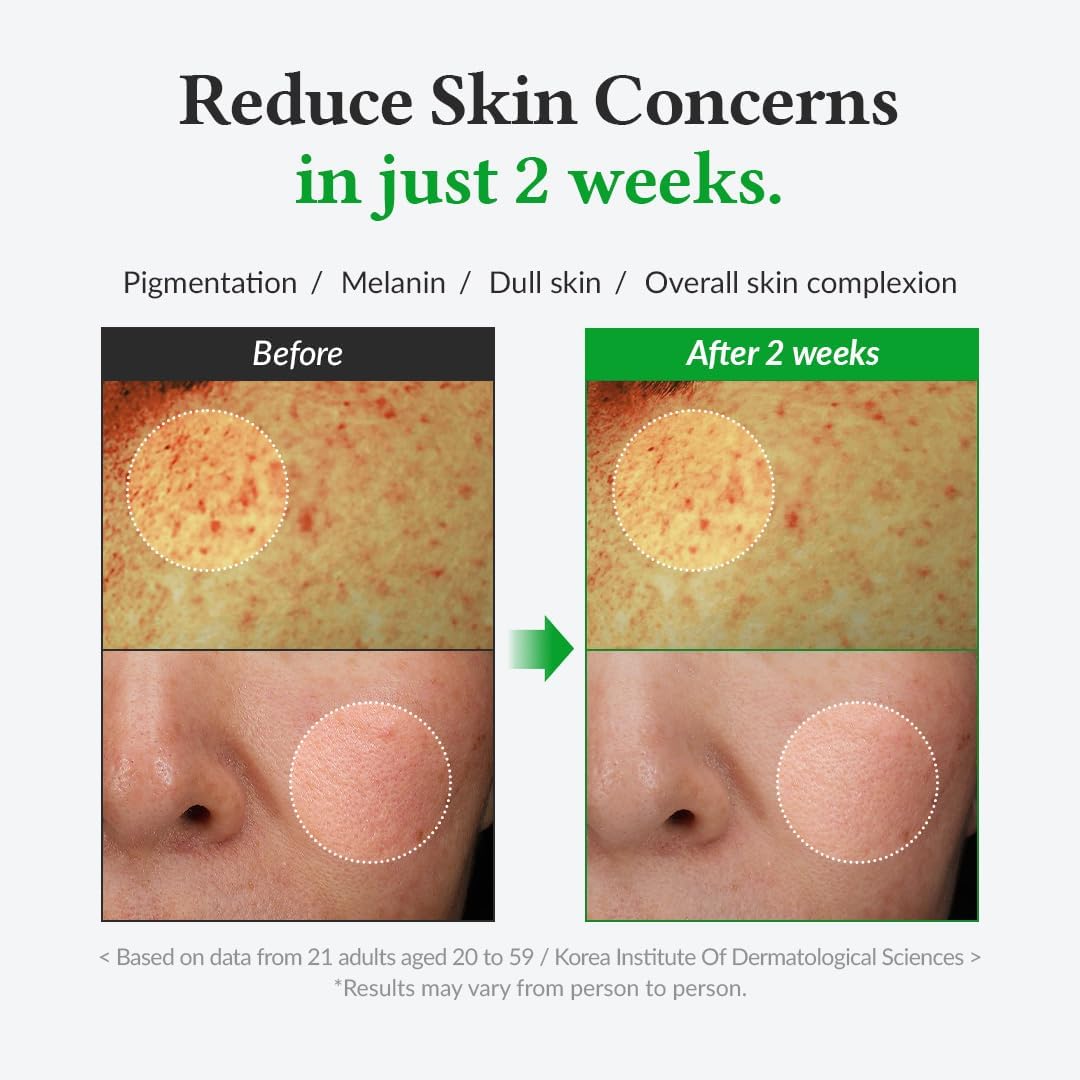 Dr. Althea Gentle Vitamin C Serum - 30ml