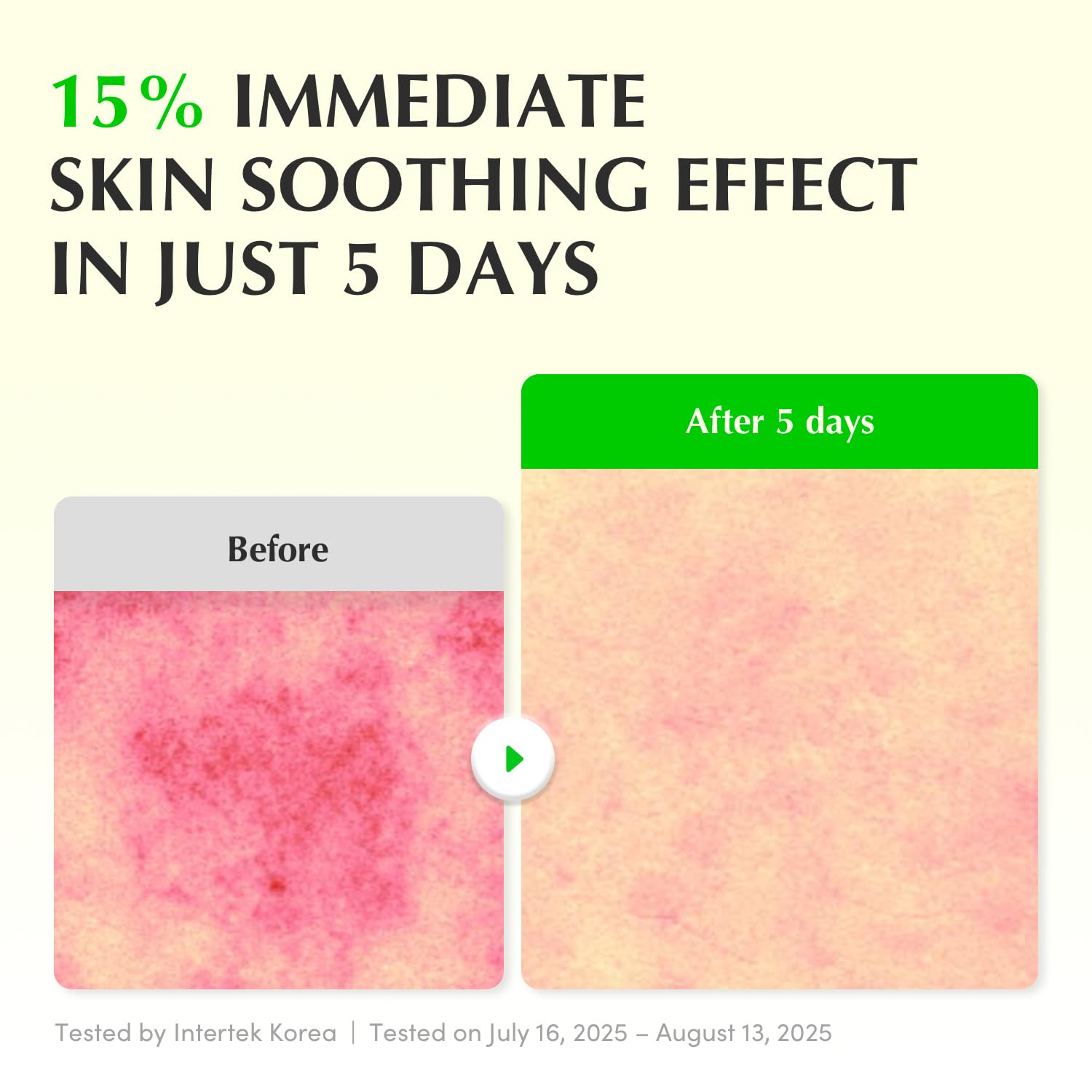 EQQUALBERRY Aloe PDRN Calming Smoothie Serum - 30ml