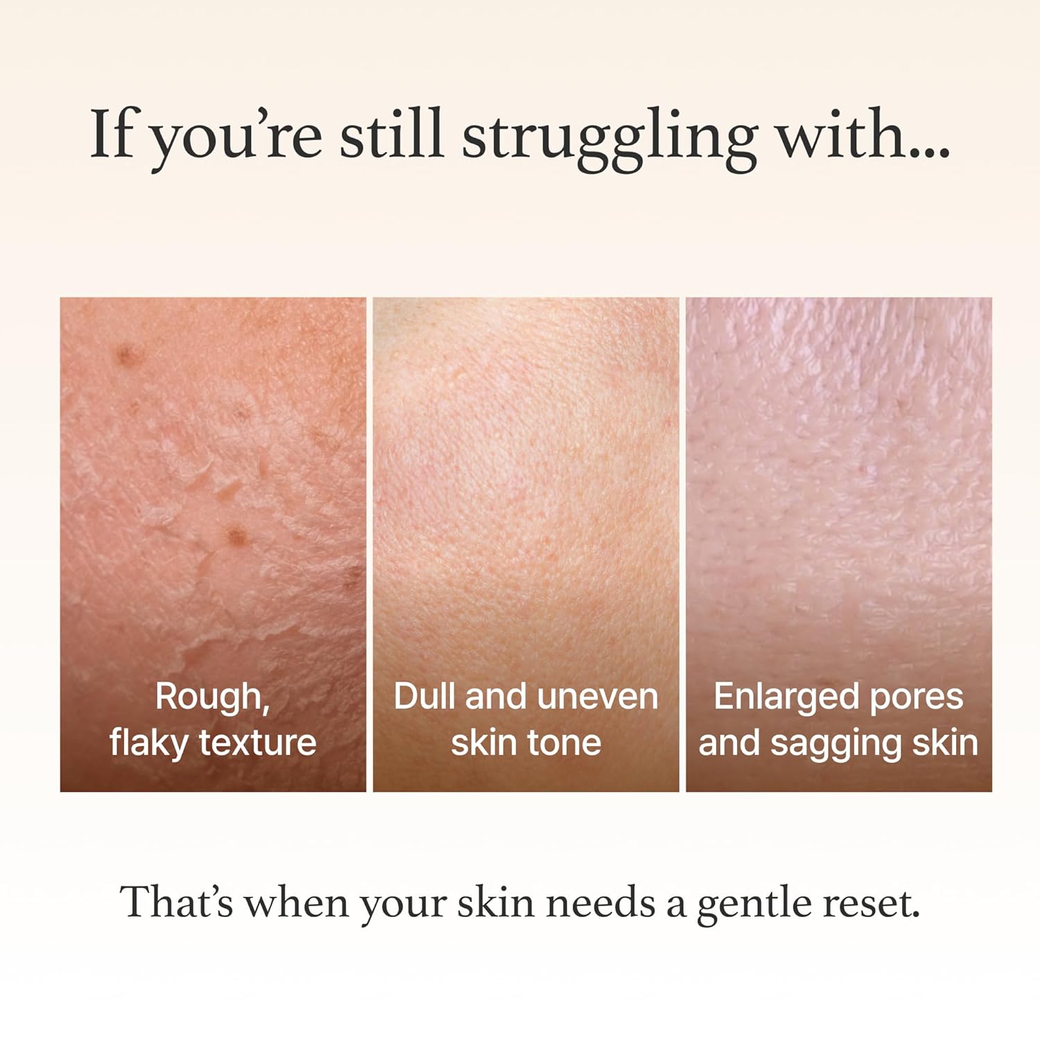 I'm from Rice Mask 3.88 Oz