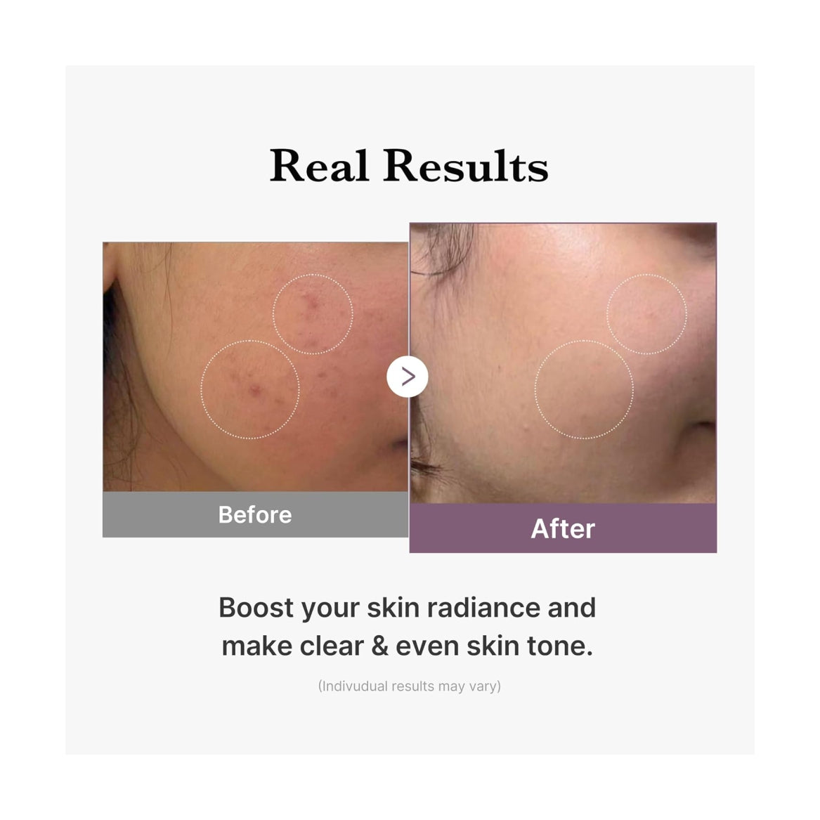 MEDICUBE Age-R Glutathione Glow Milky Toner