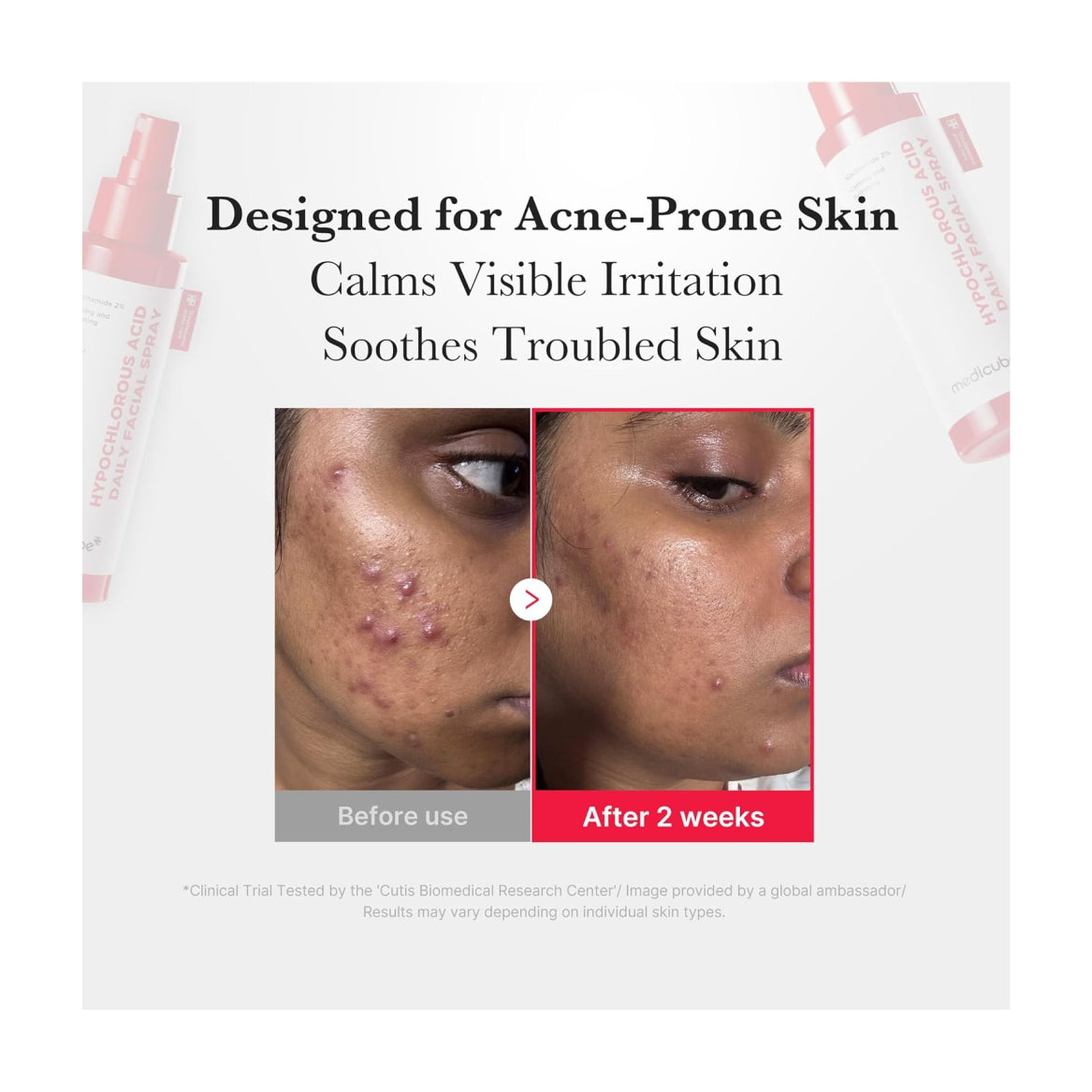 MEDICUBE Power Soothing Spray - 125 ml