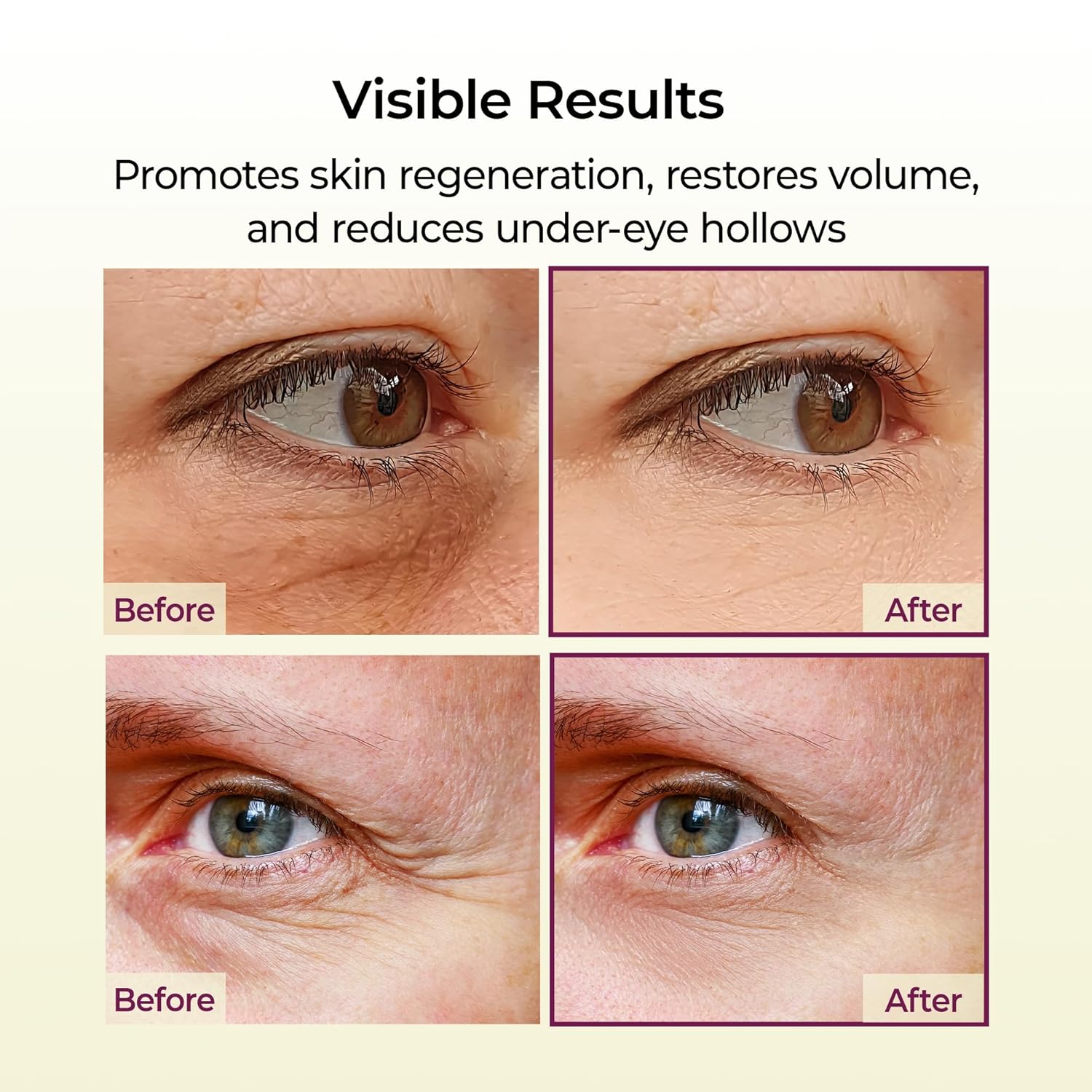 Dr. Melaxin Cemenrete Calcium Multi Balm 9g