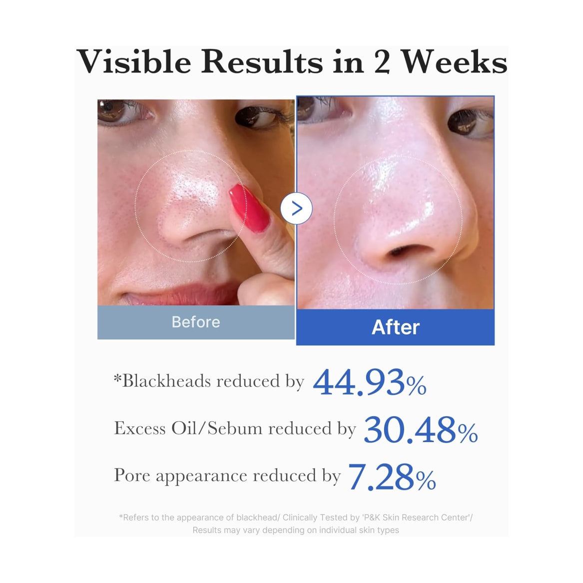 MEDICUBE Zero Pore Pads - 155 g