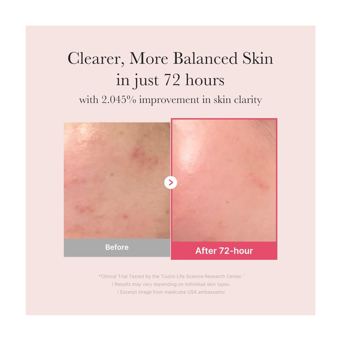 MEDICUBE TXA + Niacinamide 15% Glow Facial Serum