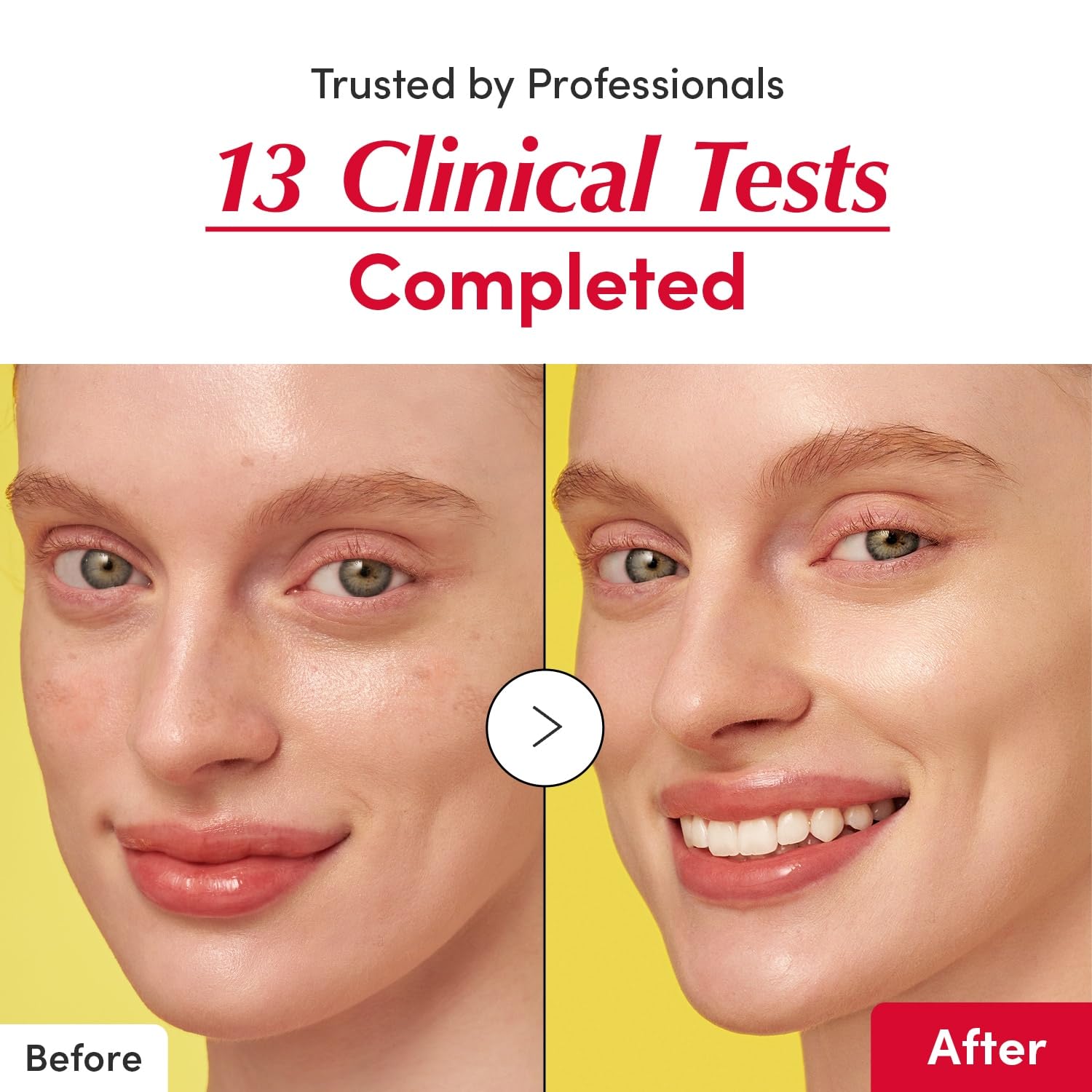 EQQUALBERRY Vitamin Illuminating Serum - 30ml