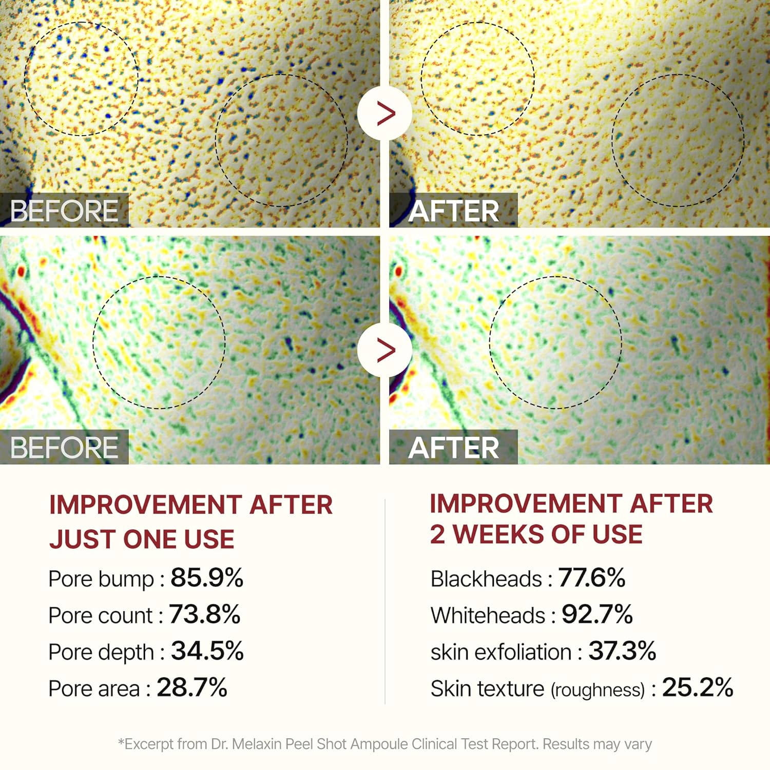 Dr. Melaxin Peel Shot Glow Rice Peeling Ampoule - 80ml