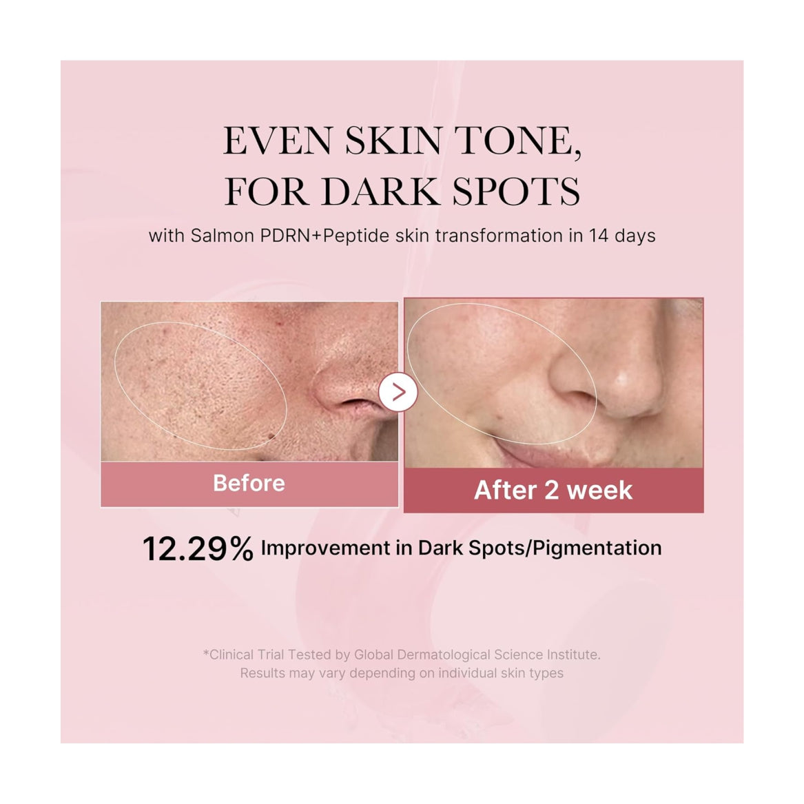 MEDICUBE Salmon DNA PDRN Pink CICA Soothing Toner