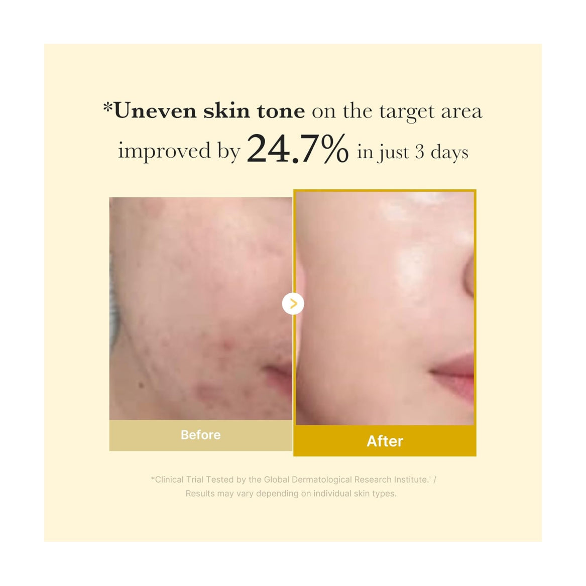 MEDICUBE Kojic Acid Turmeric Overnight Wrapping Peel Off Mask